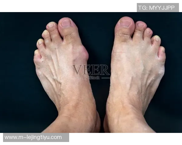 加兰左脚大脚趾再度受伤复查结果将影响未来比赛安排